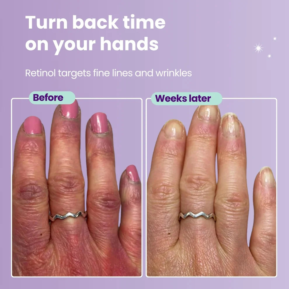 Retinol Handáburður